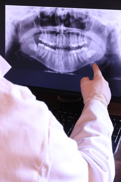 Best Emergency Broken Tooth Repair in New Cumberland, PA