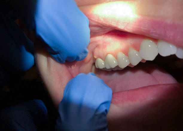 Best Emergency Dental Care for Trauma or Injury in New Cumberland, PA